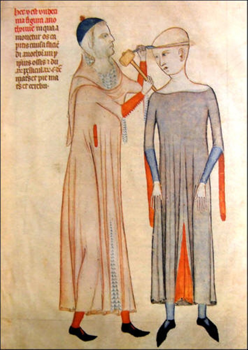 medieval-medical-experiments.jpg
